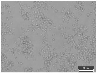 Separating and culturing method for feeder-layer-free rat spermatogonial stem cells