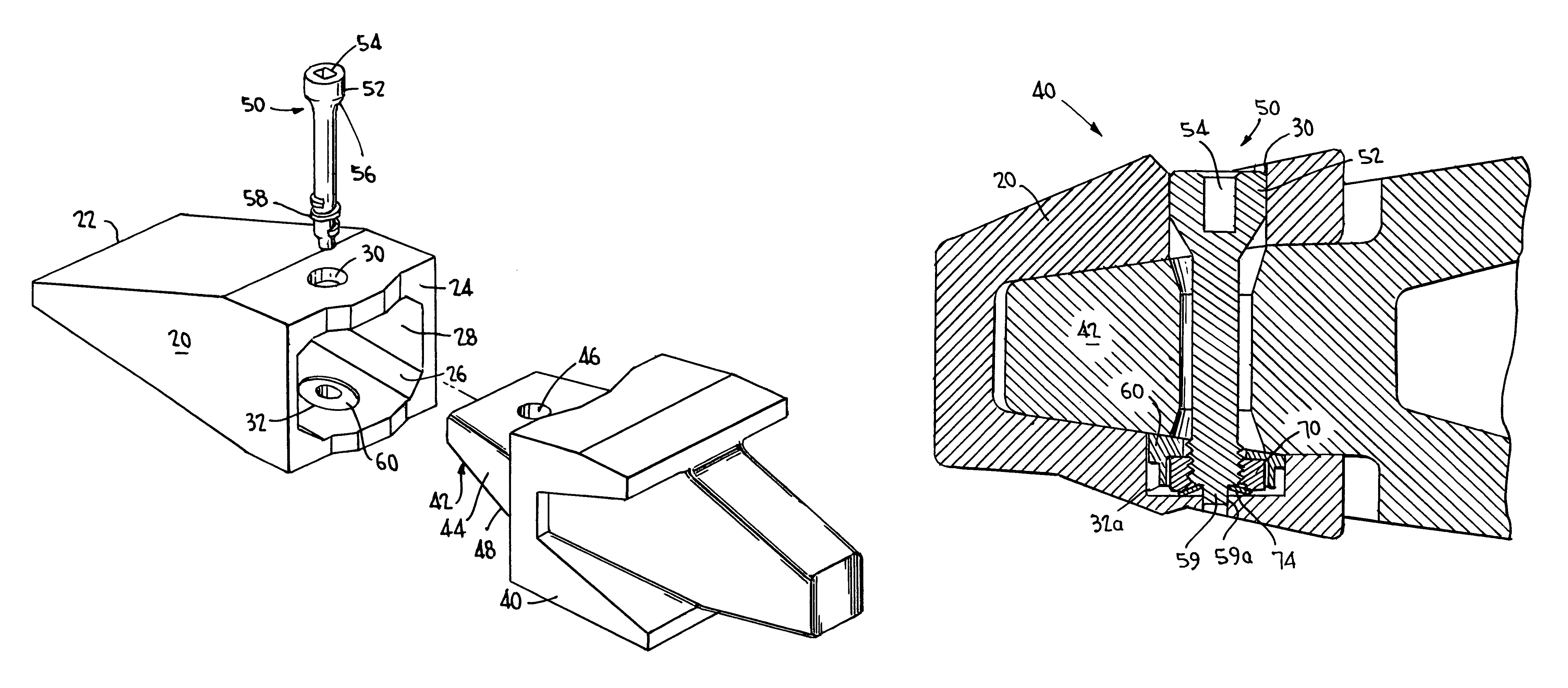 Excavation retention assembly