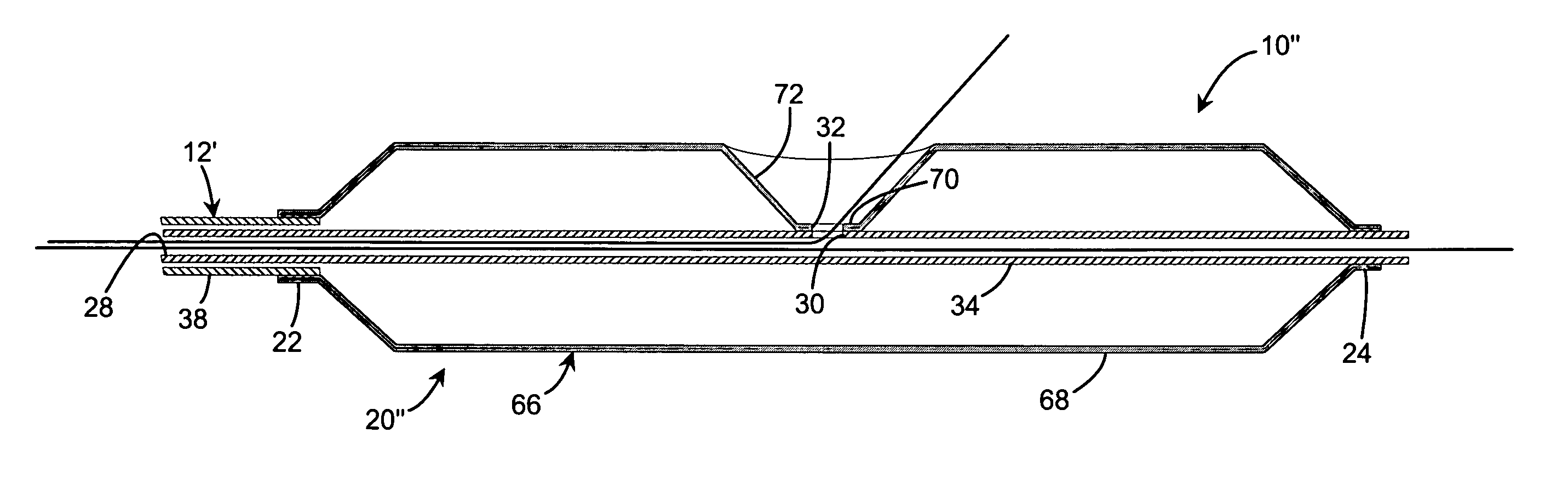 Apparatus and method for stenting bifurcation lesions