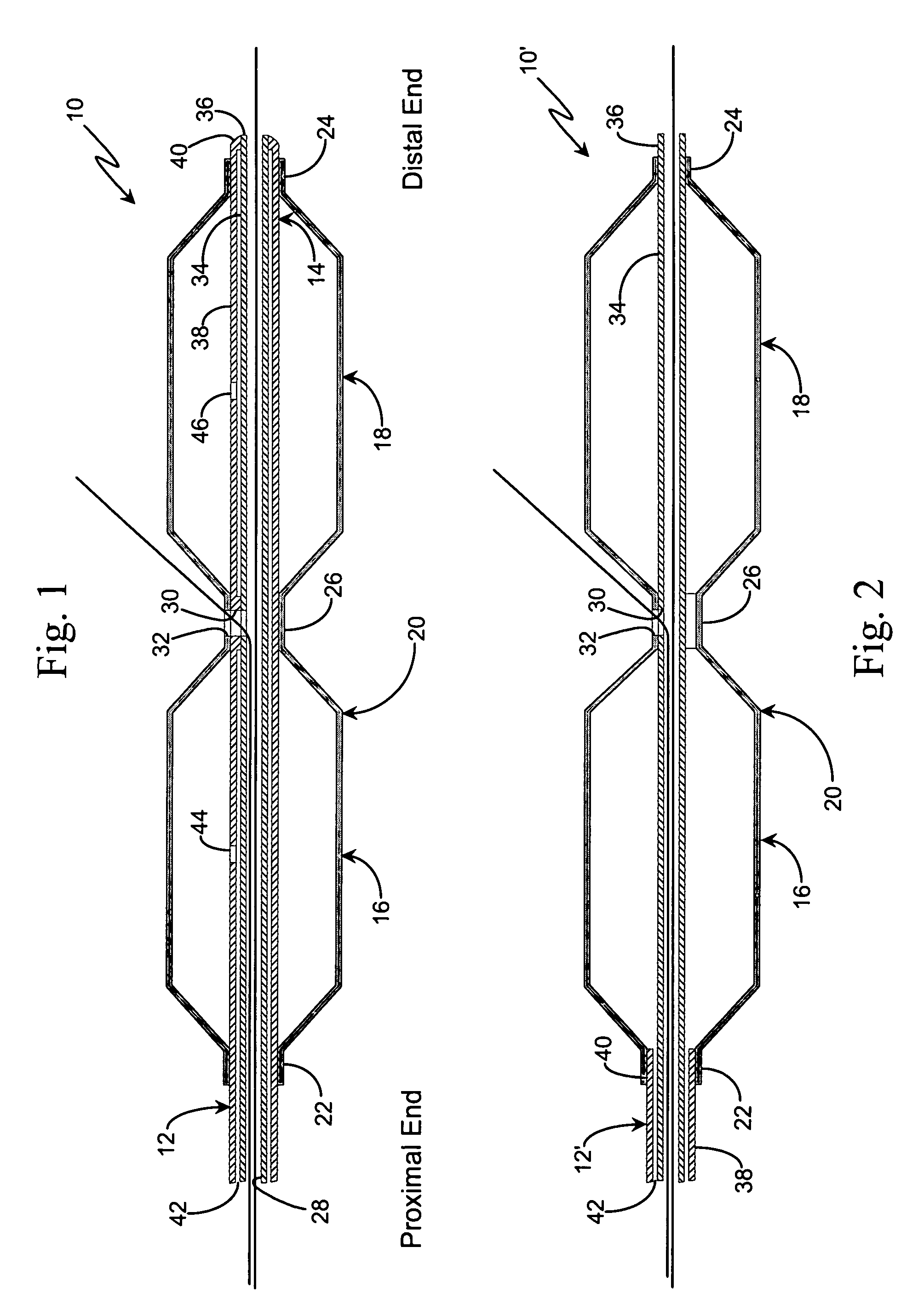 Apparatus and method for stenting bifurcation lesions