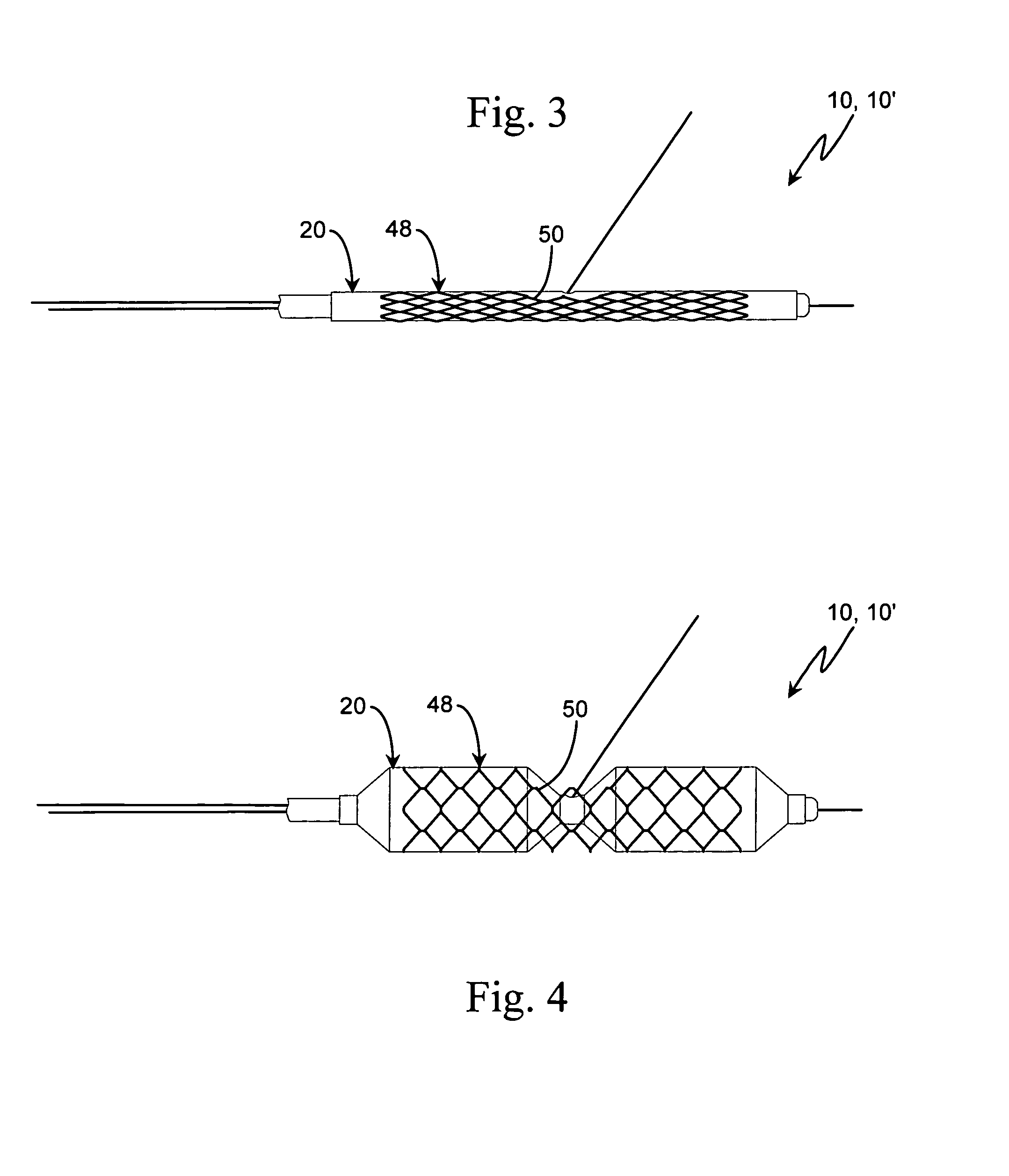Apparatus and method for stenting bifurcation lesions