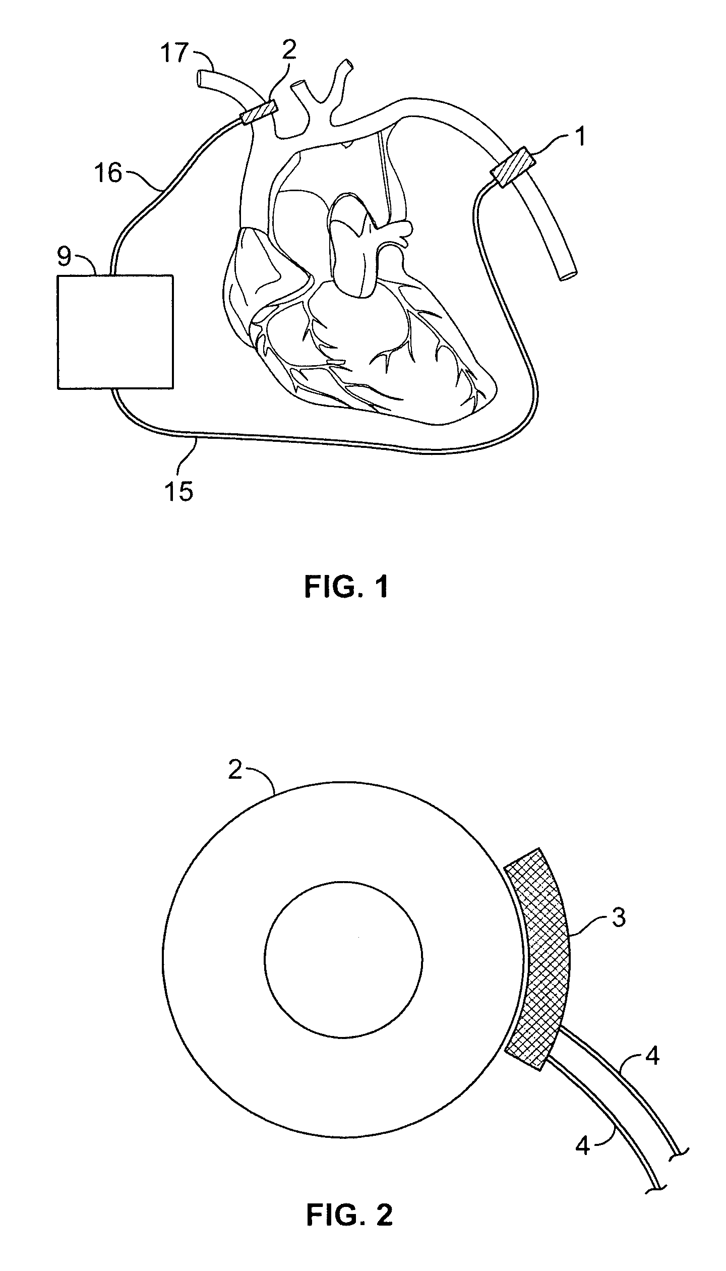 Devices for counteracting hypotension