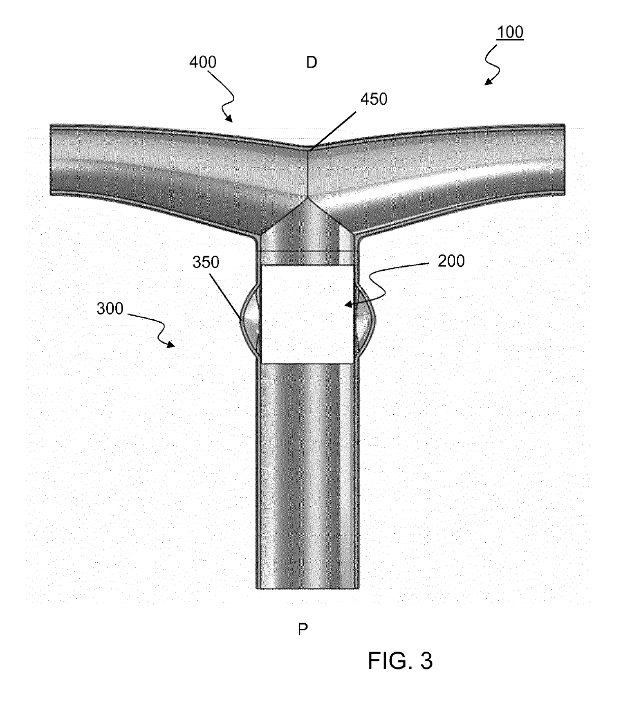 Vascular Valved Prosthesis and Manufacturing Method