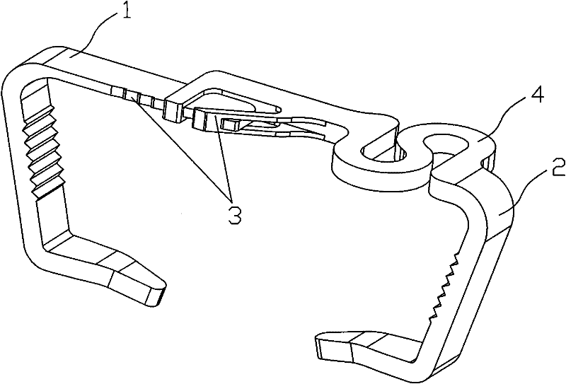 Sternum median incision connector