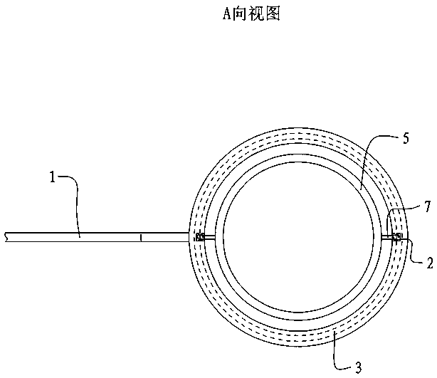 A multifunctional alcohol storage tank for prk surgery