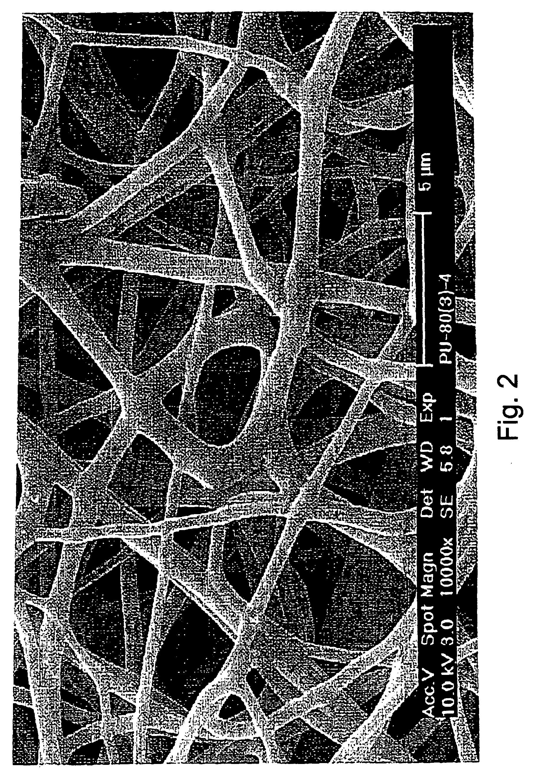 Vascular prosthesis and method for production thereof