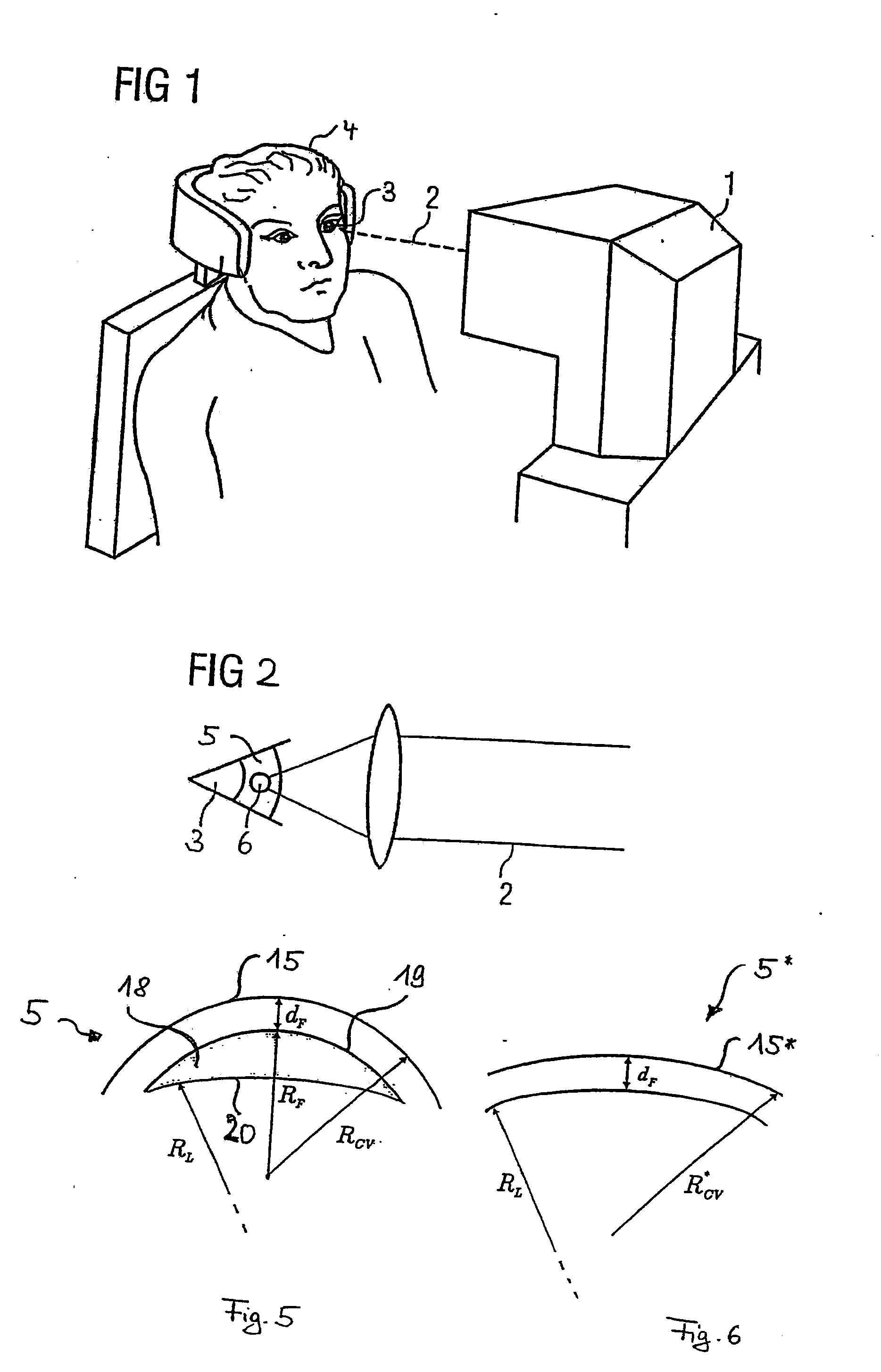 Treatment device for operatively correcting defective vision of an eye, method for producing control data therefor and method for operatively correcting defective vision of an eye