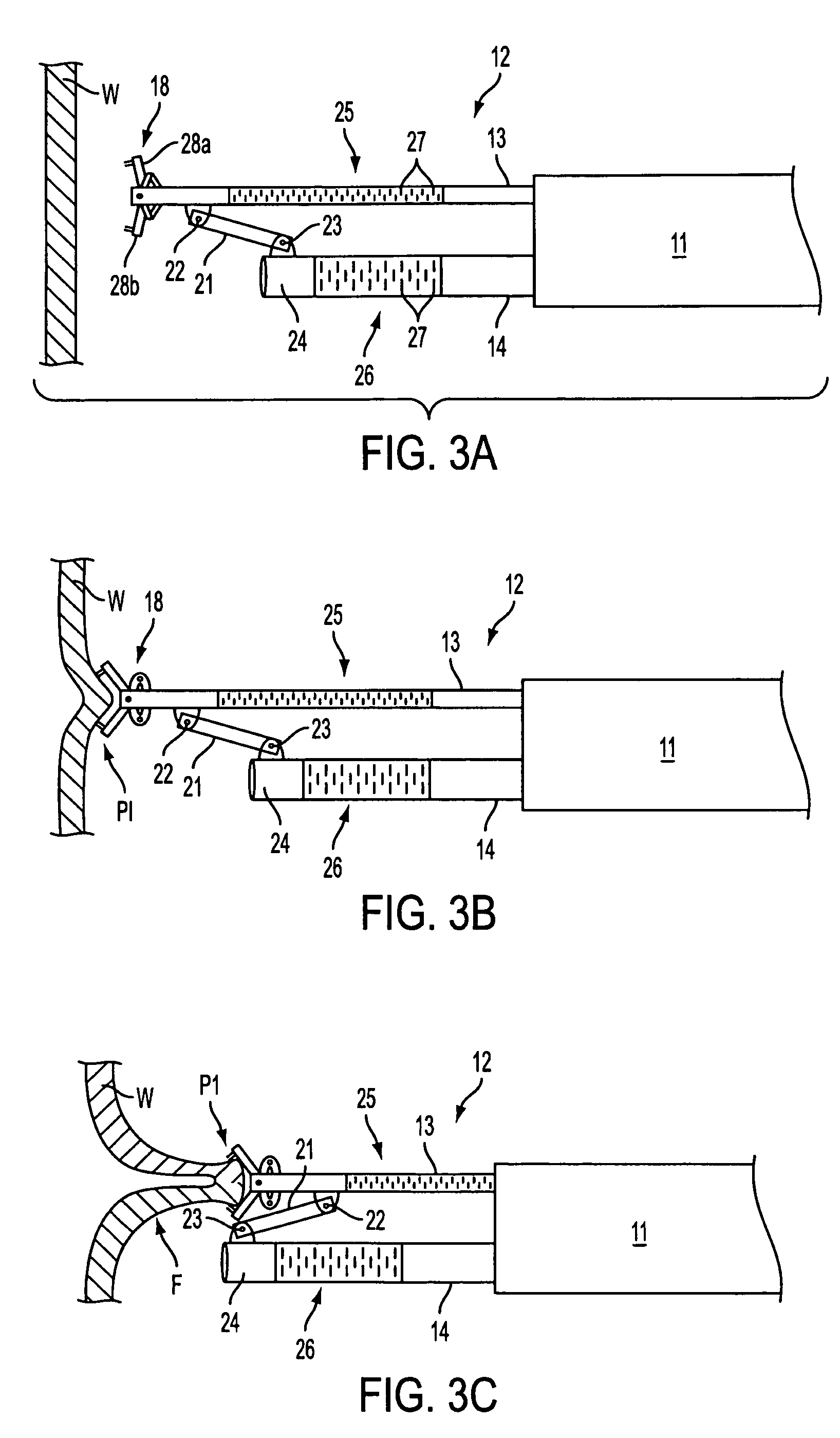 Apparatus and methods for forming gastrointestinal tissue approximations