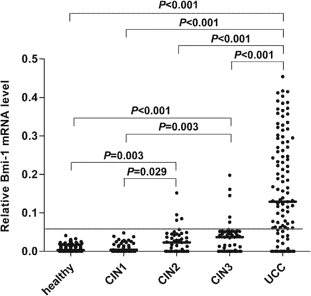 Special kit and method for detecting mRNA of gene Bmi-1 in blood plasma of patients with cervical cancer