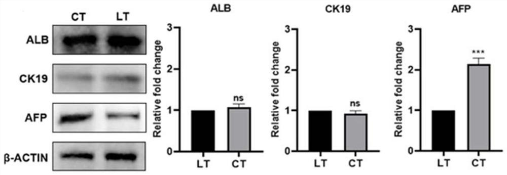 Primary mouse liver cancer model based on liver oval cell malignancy as well as establishment method and application of primary mouse liver cancer model