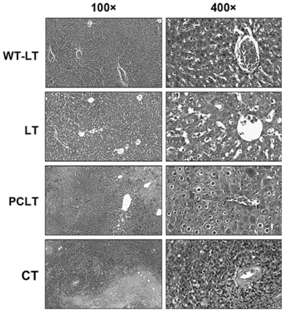 Primary mouse liver cancer model based on liver oval cell malignancy as well as establishment method and application of primary mouse liver cancer model