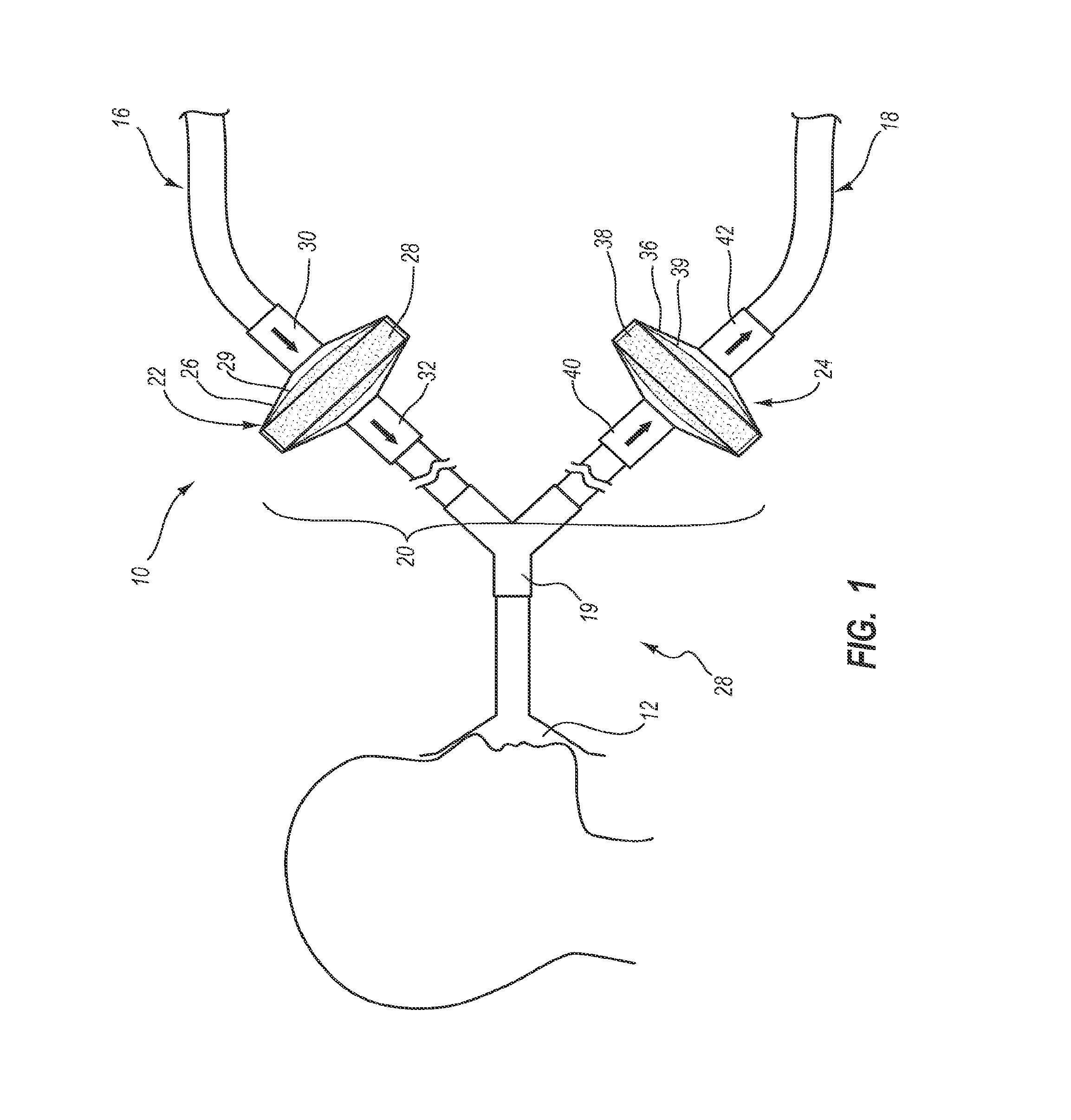 System, Method and Apparatus for Removal of Volatile Anesthetics for Malignant Hyperthermia