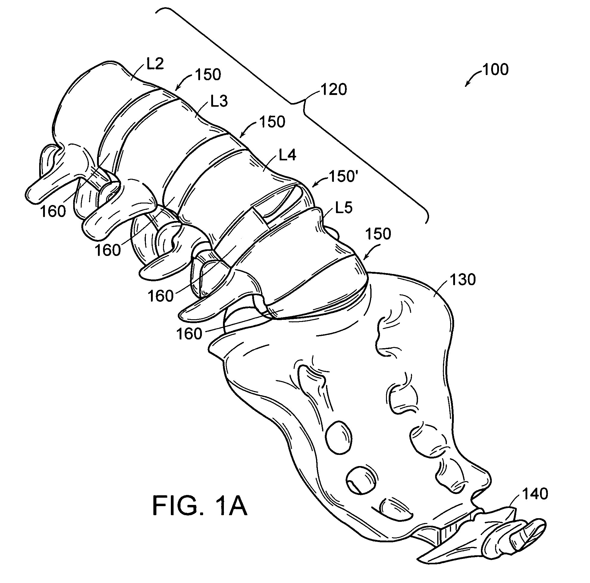 Method and apparatus for artificial disc insertion