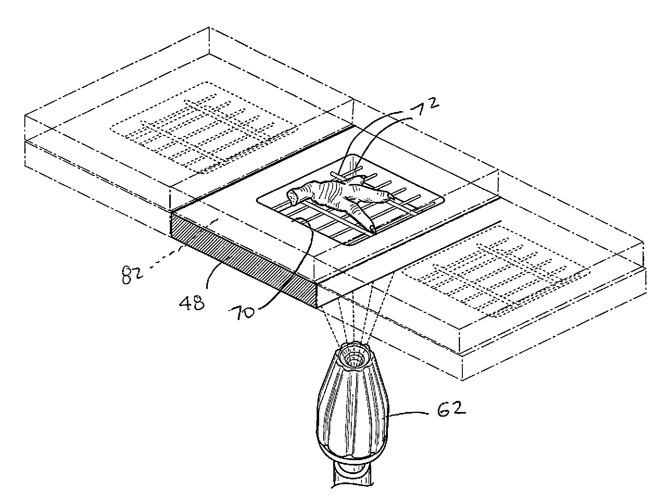Device for removing material from feet of poultry