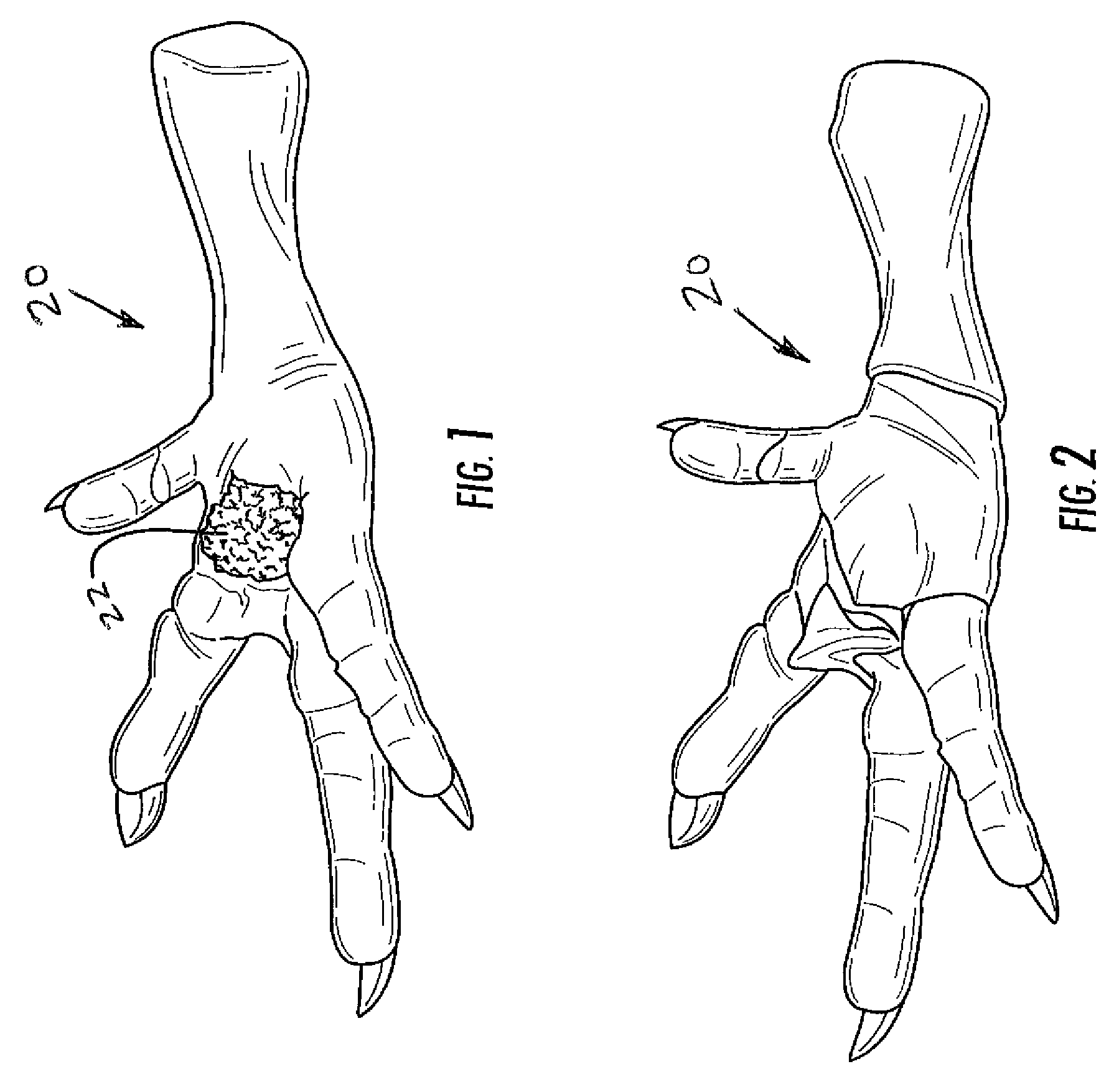 Device for removing material from feet of poultry