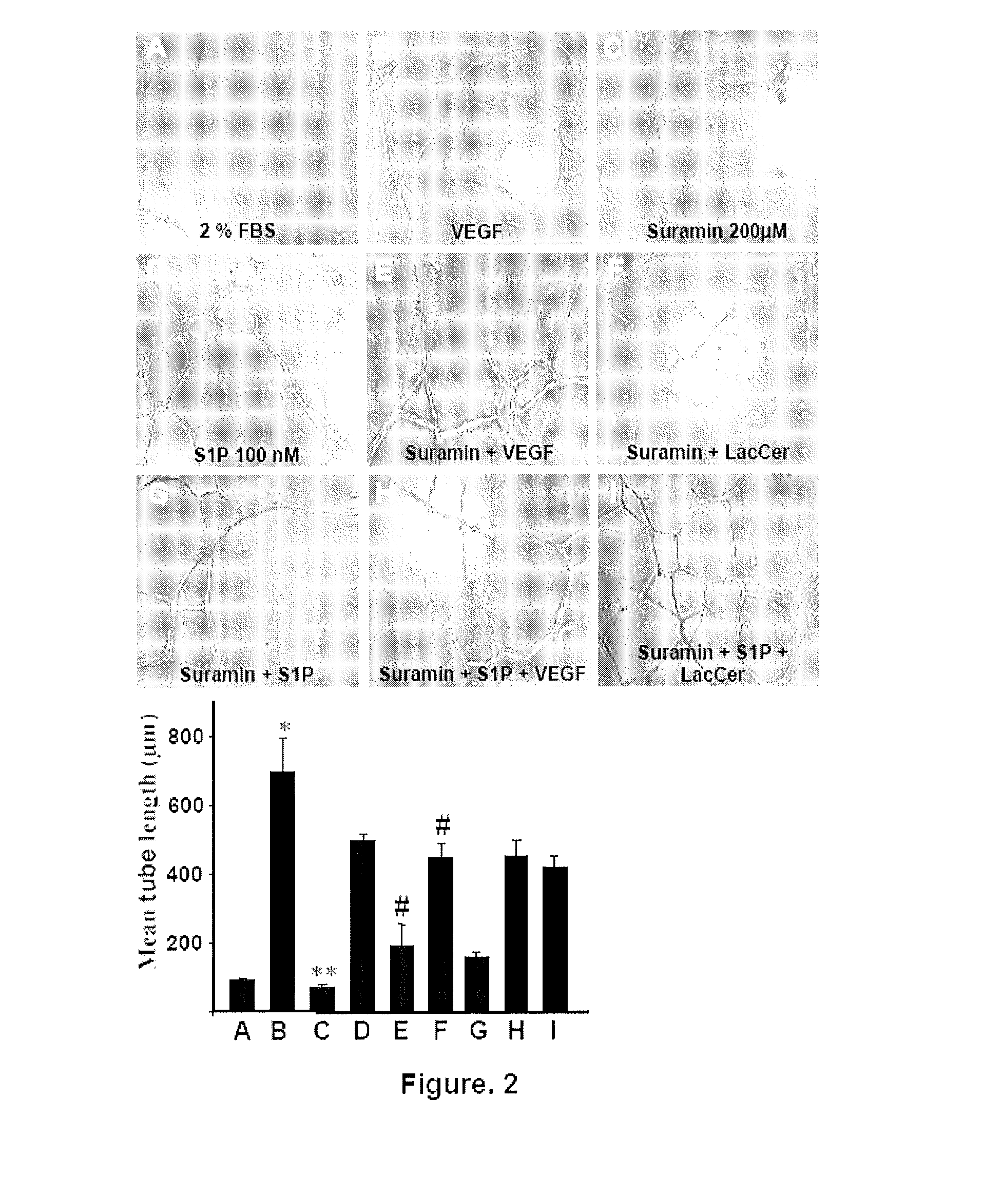 Use of the Lactosylceramide Synthase Isoform B1,4GALT-V as a Biomarker for Cancer