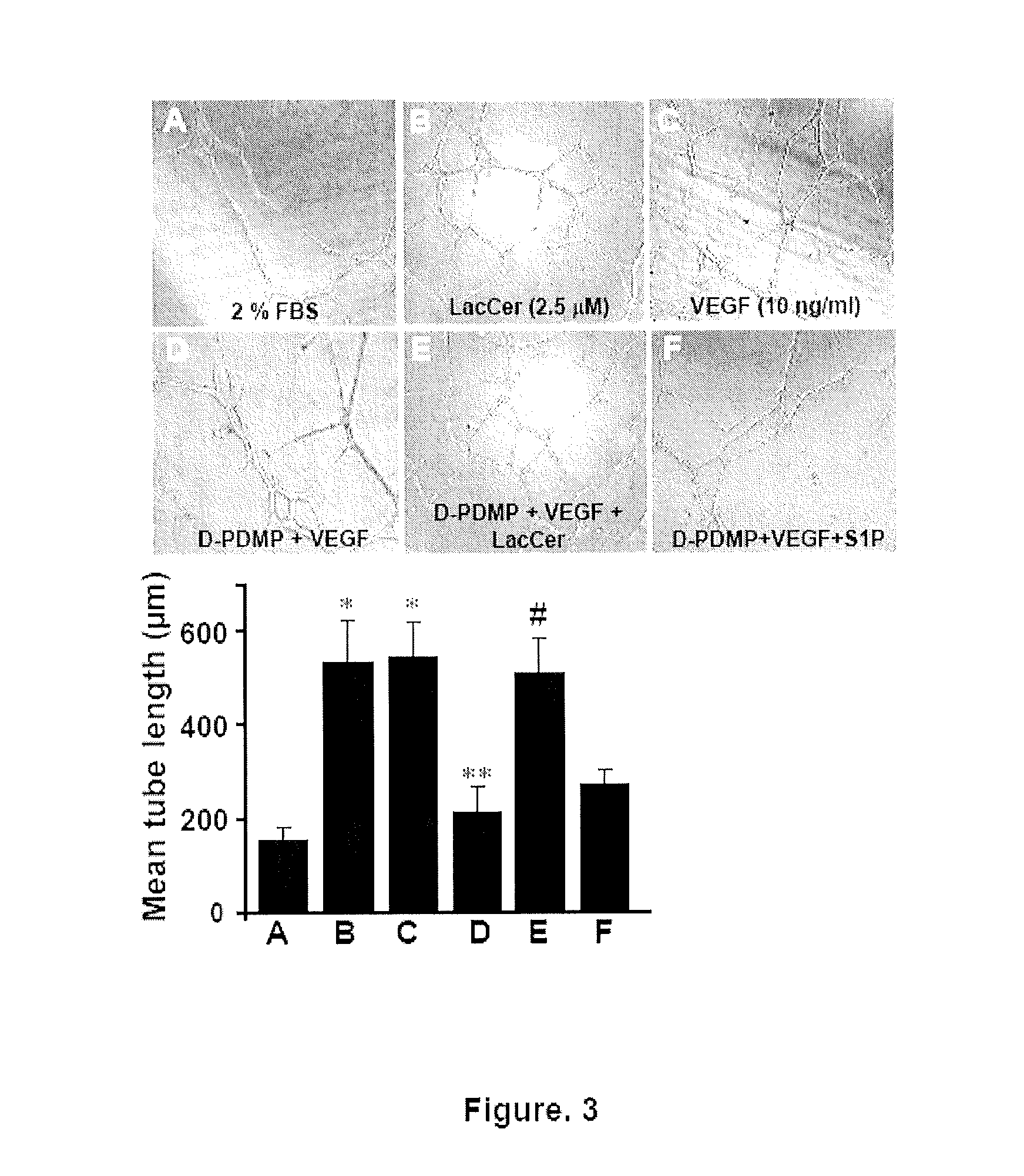 Use of the Lactosylceramide Synthase Isoform B1,4GALT-V as a Biomarker for Cancer