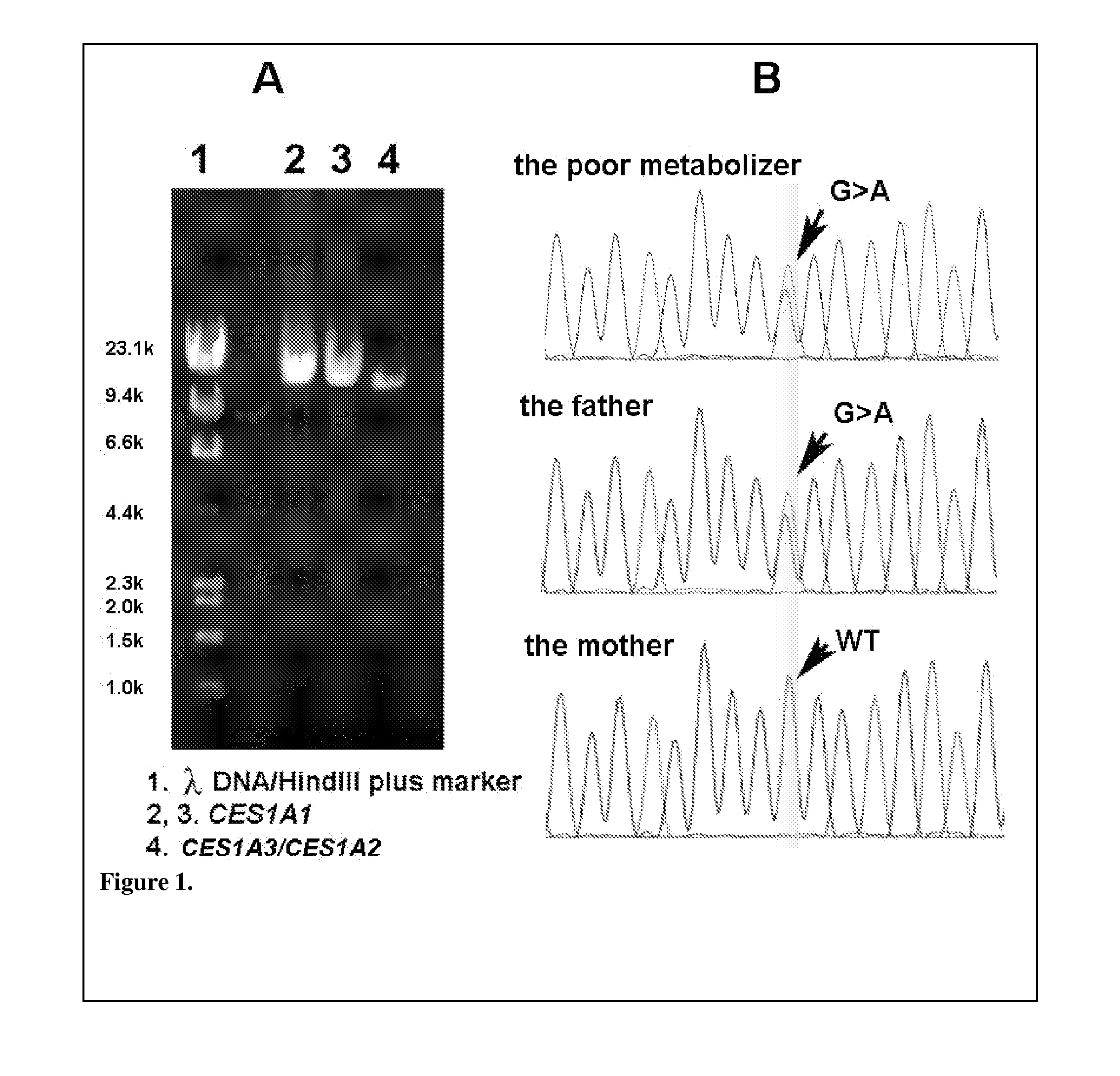 Compositions and methods for genotyping ces1 genetic variants and use thereof