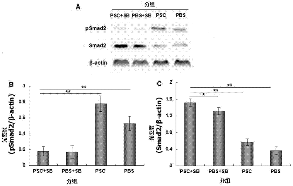 Application of tgf-β1 receptor blocker in the preparation of drugs for preventing recurrence of echinococcosis