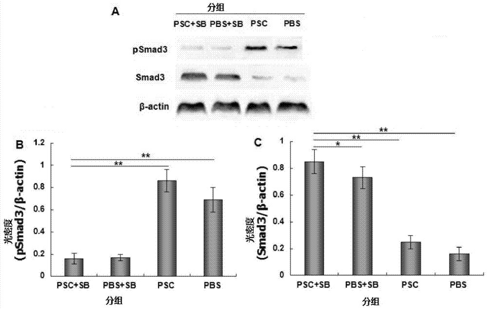 Application of tgf-β1 receptor blocker in the preparation of drugs for preventing recurrence of echinococcosis