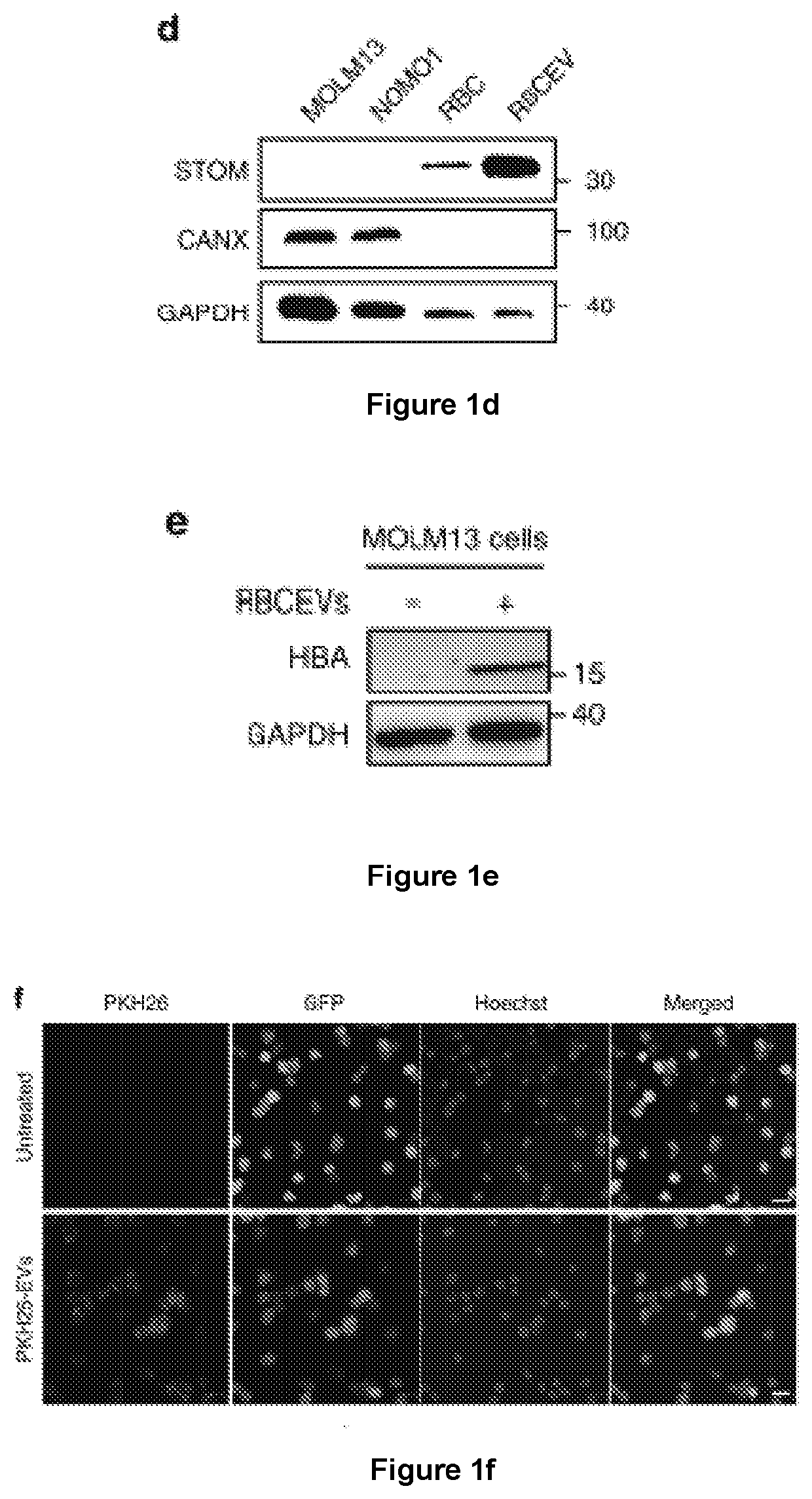 Cargo loaded extracellular vesicles