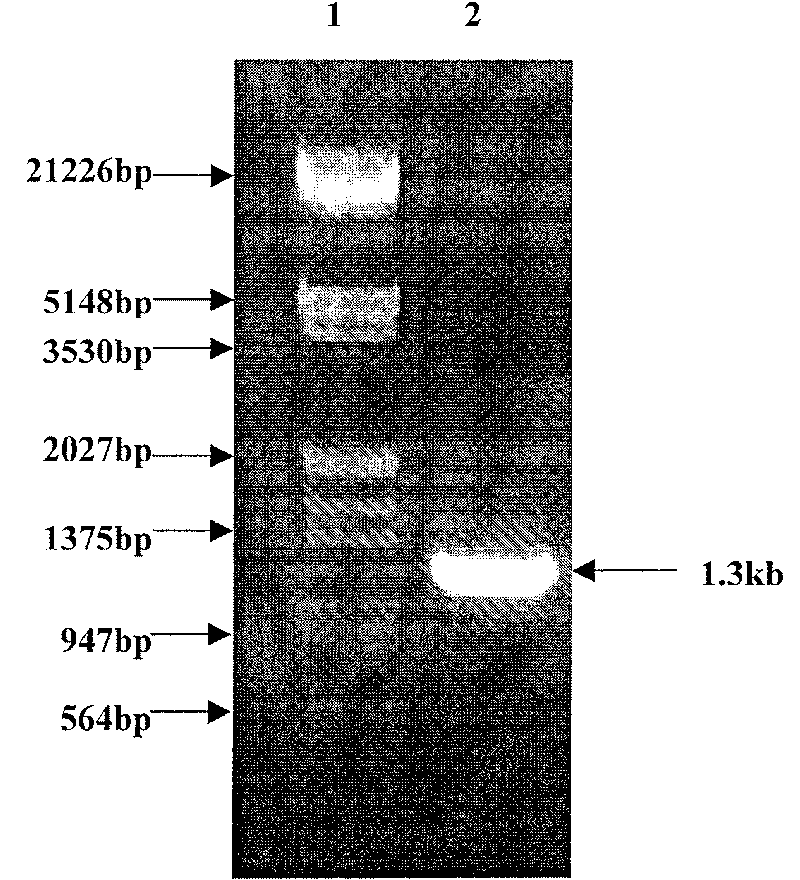 Method for preparing tetanus toxin recombinant antigen and its use