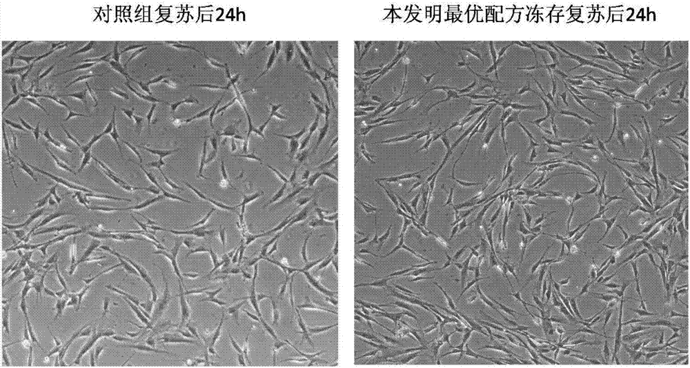 Clinic freeze-preservation protective solution composition for umbilical cord mesenchymal stem cells and application thereof