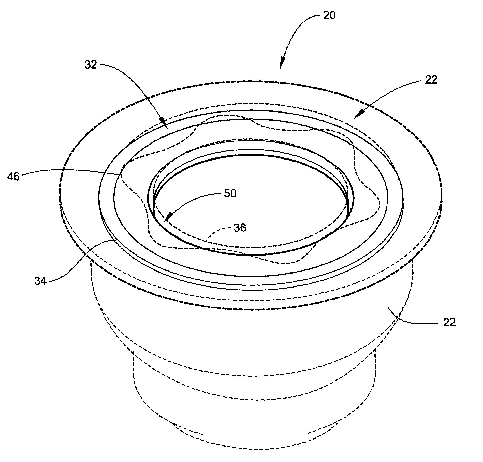 Tangential stress reduction system in a loudspeaker suspension