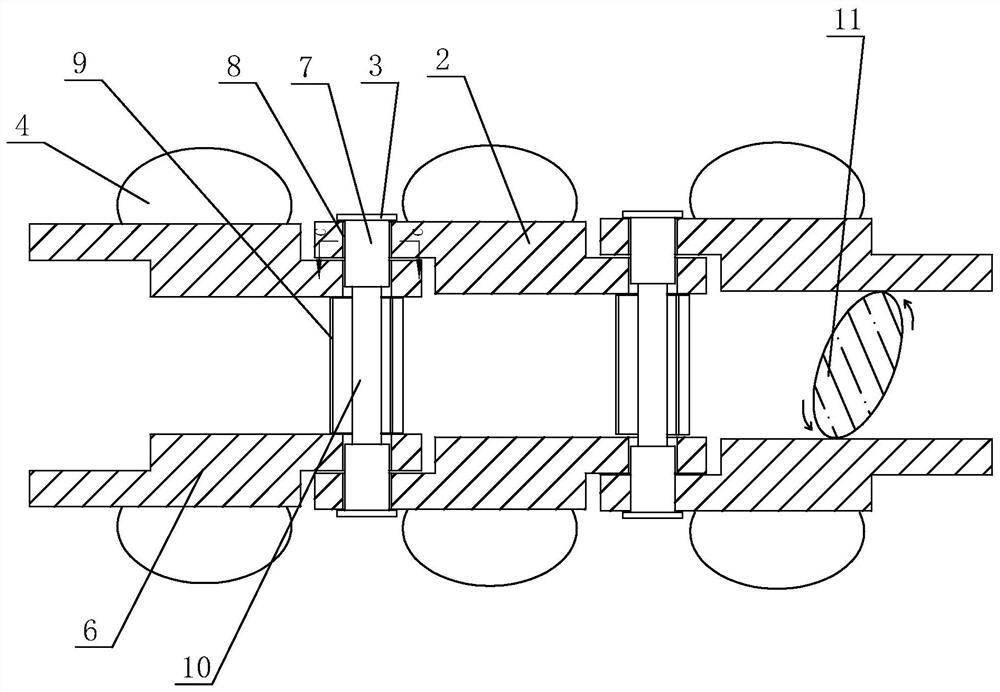 Special posterior chain type external prosthesis artificial lumbar intervertebral disc and implantation method thereof