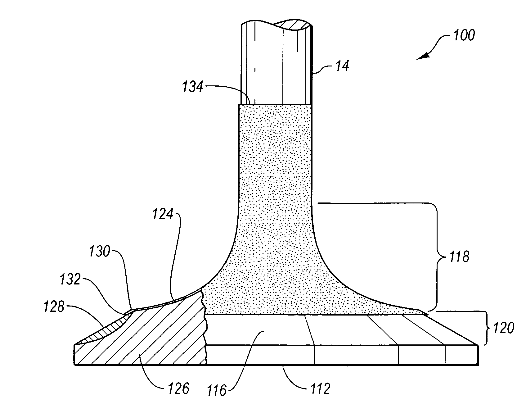 Inlet valve having high temperature coating and internal combustion engines incorporating same