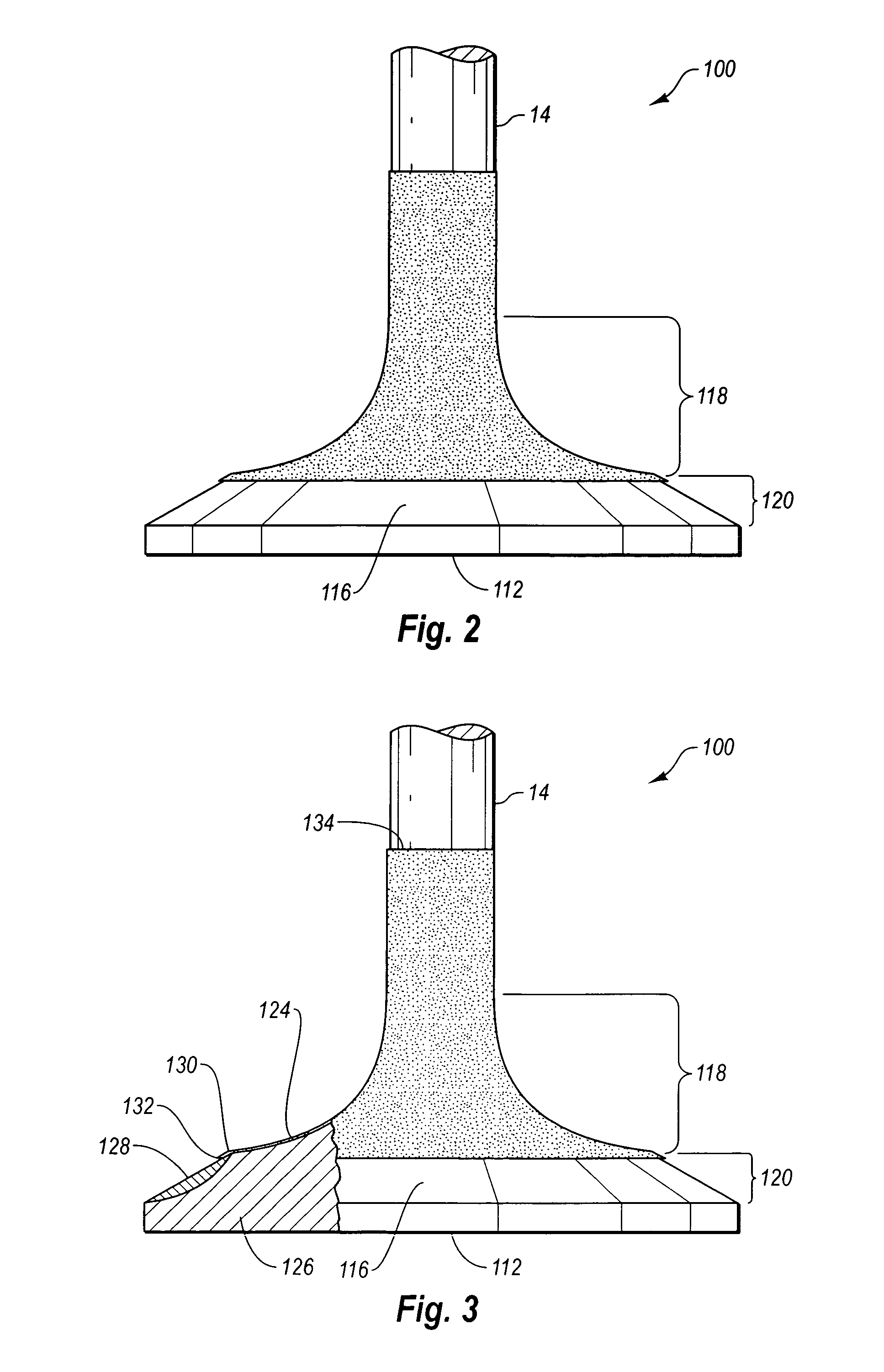 Inlet valve having high temperature coating and internal combustion engines incorporating same