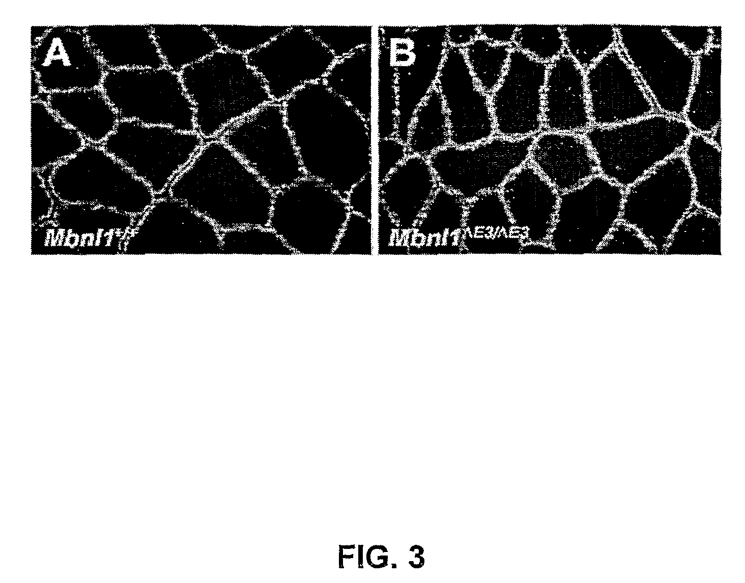 Methods and compositions for treatment of myotonia