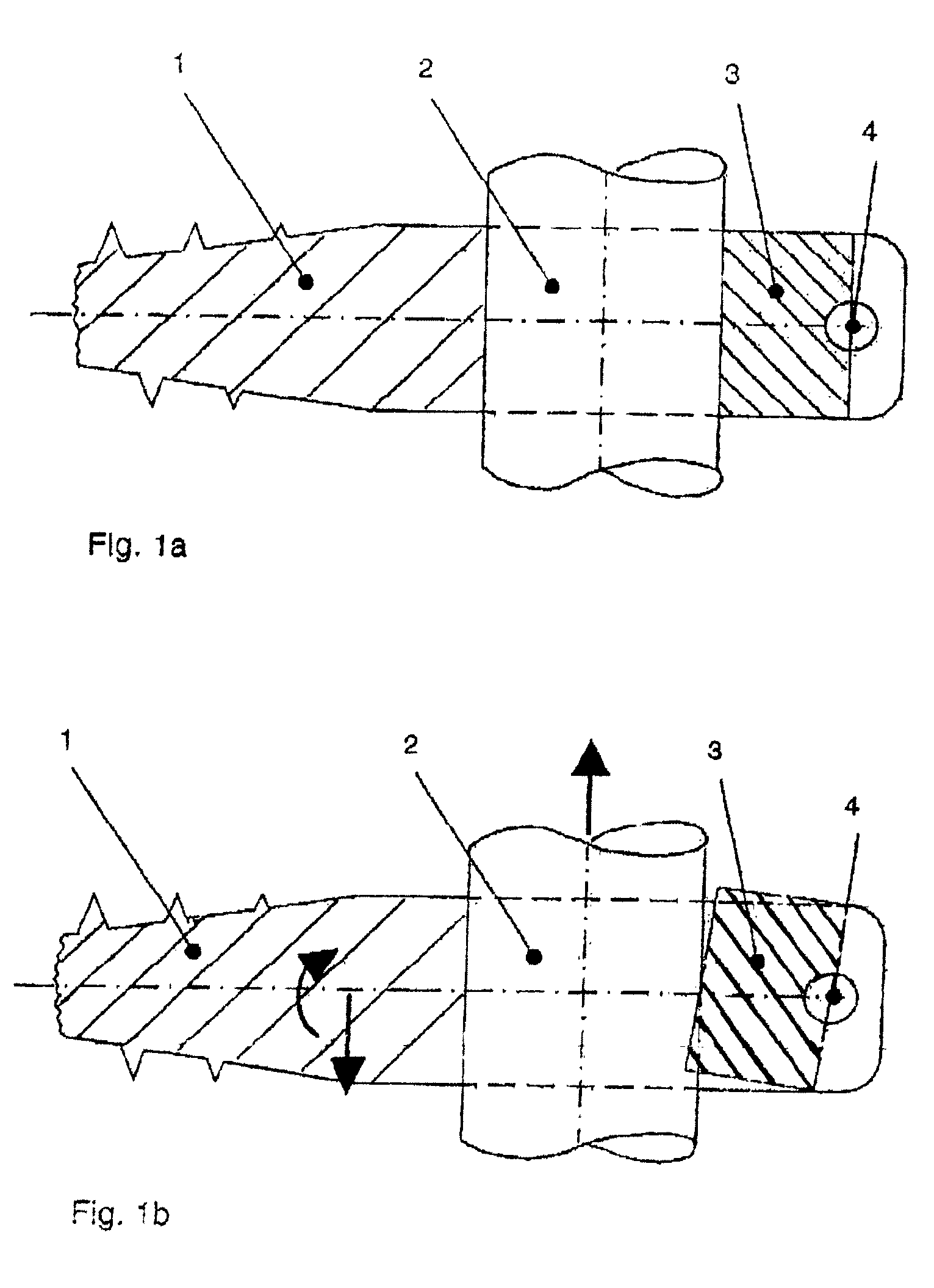 Dynamic clamping device for spinal implant