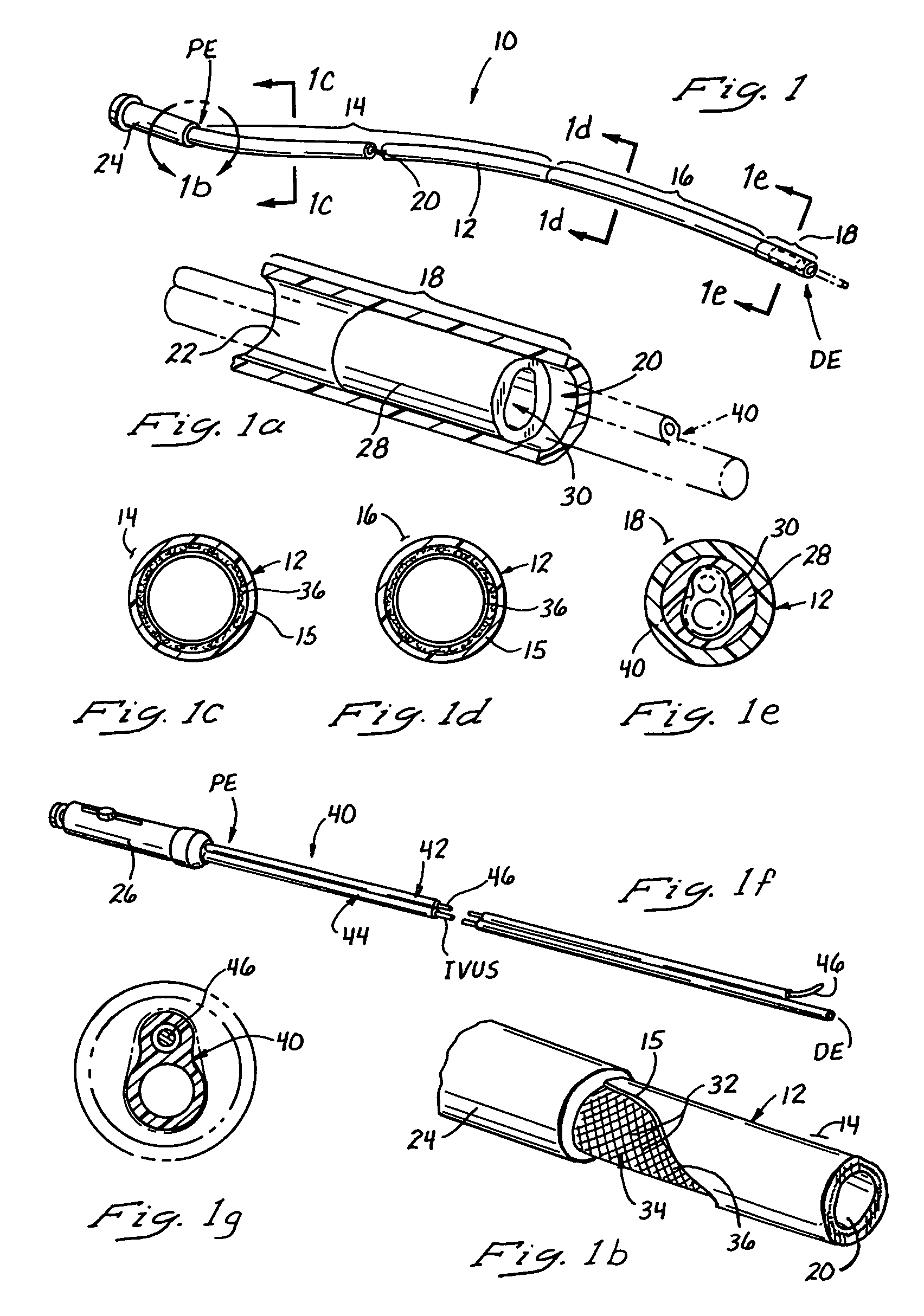 Catheters and related devices for forming passageways between blood vessels or other anatomical structures