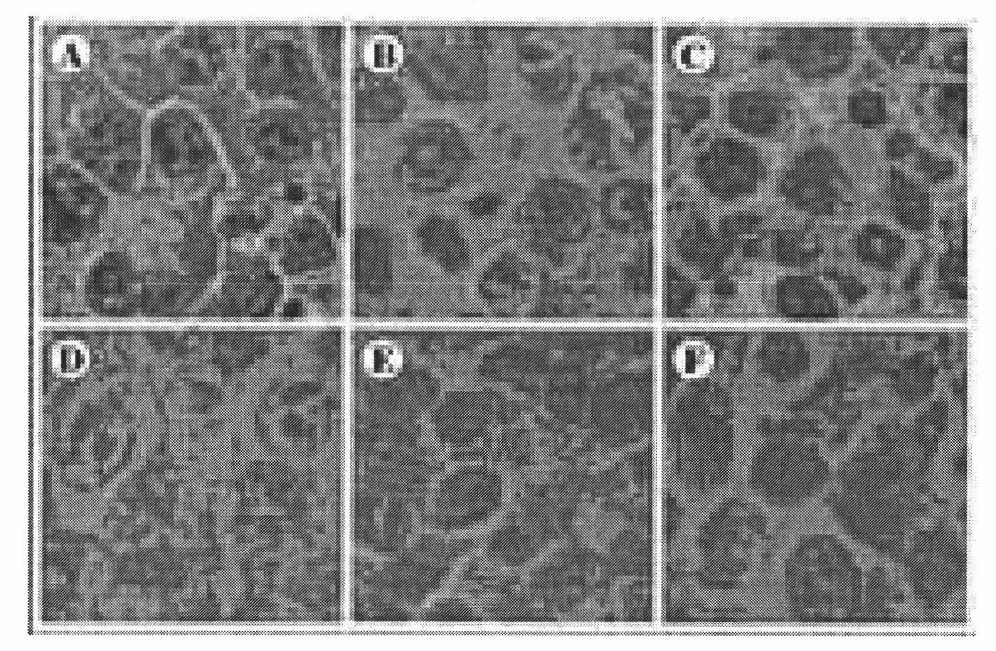 Application of composite of sweet wormwood herb and turtle shell in preparing antitumor medicine