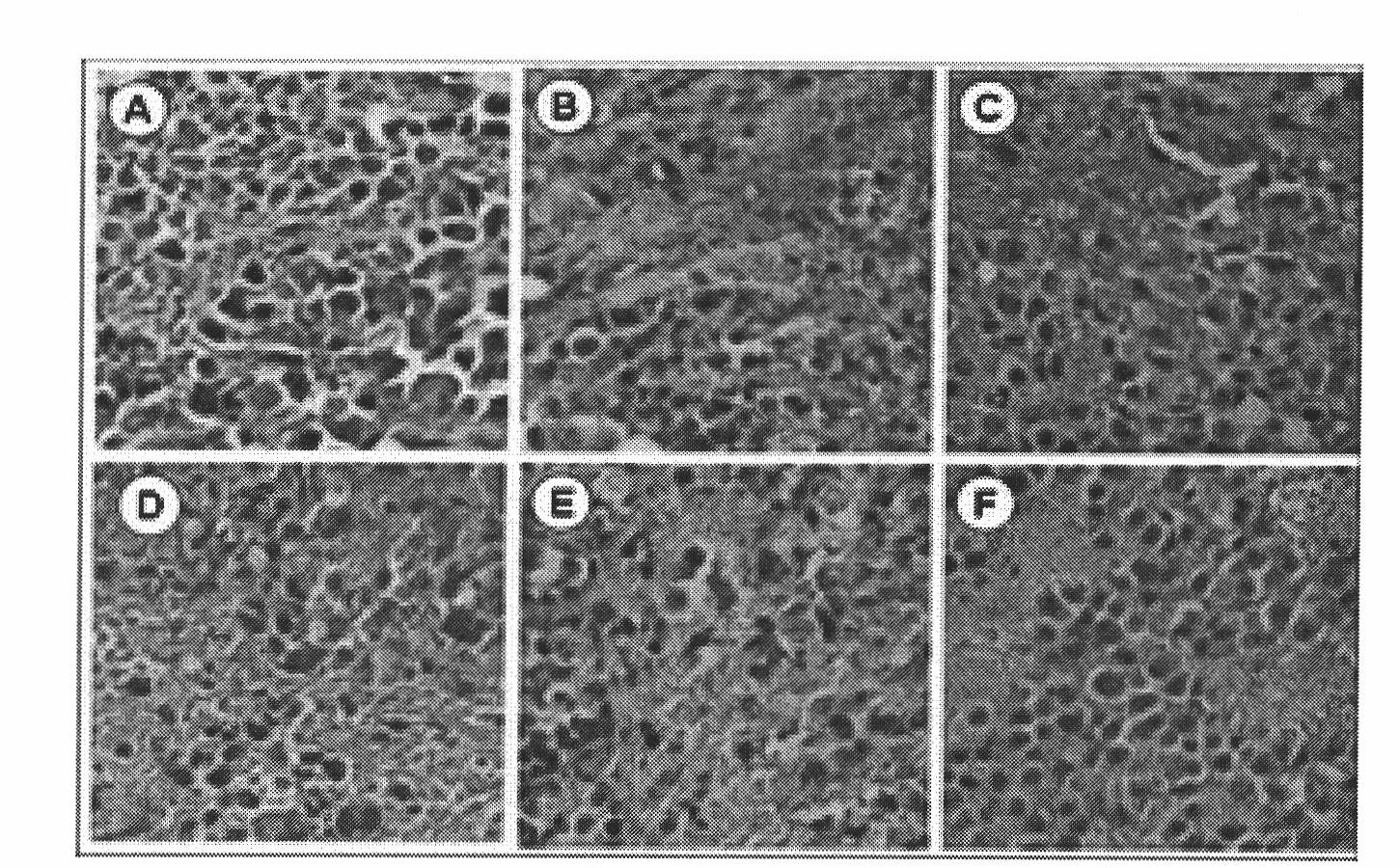 Application of composite of sweet wormwood herb and turtle shell in preparing antitumor medicine