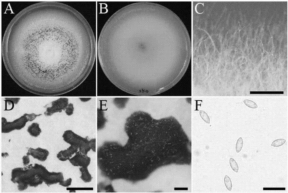 Grape endophytic fungus and application thereof in preventing and controlling grape gray mold rot