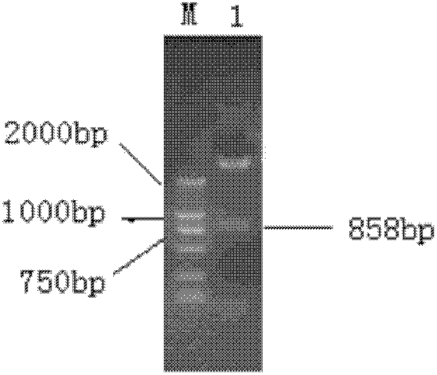 Construction of recombinant bacteria expressing avian encephalomyelitis virus VP1 protein