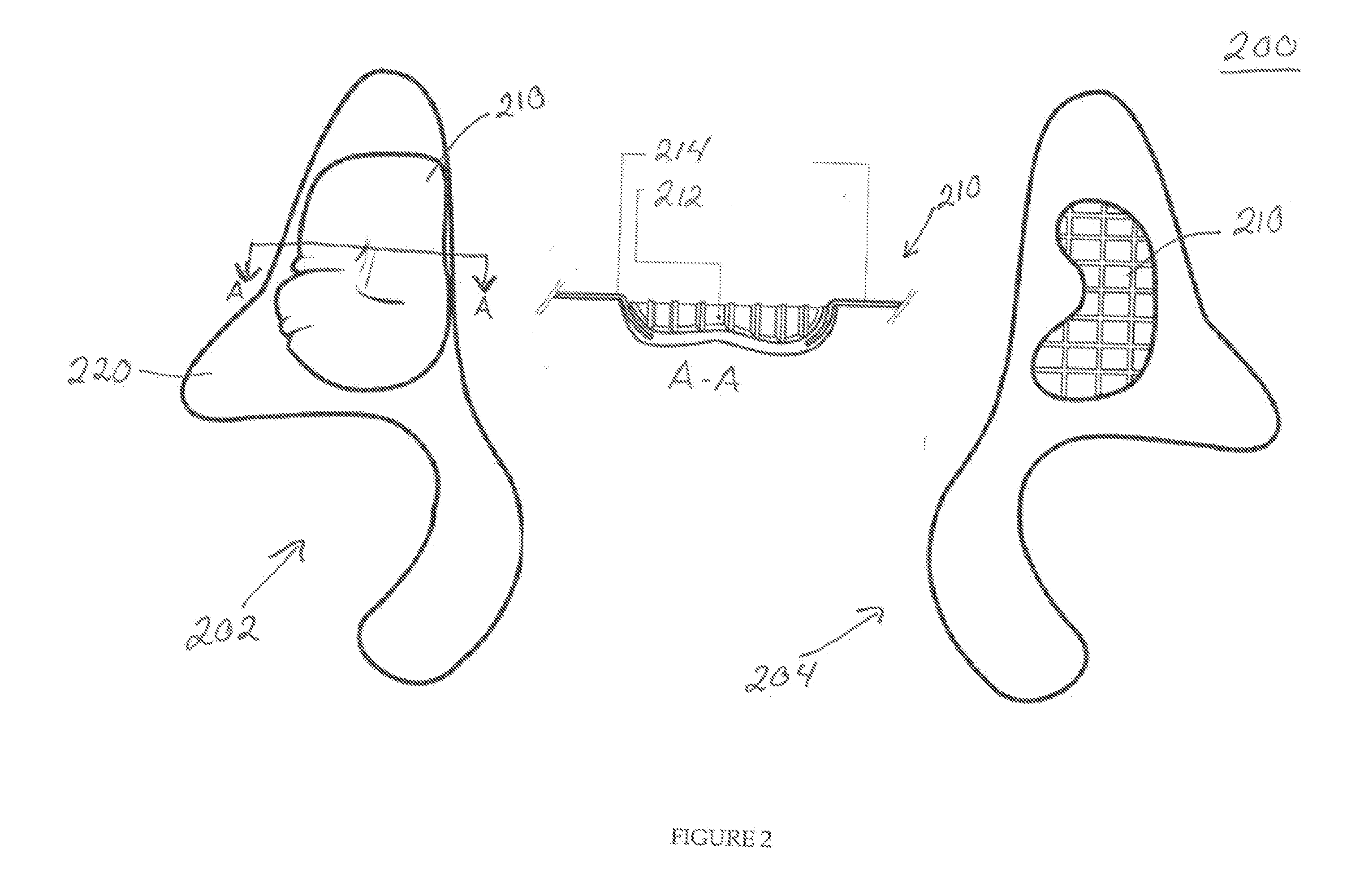 Wrist protecting glove and methods thereof