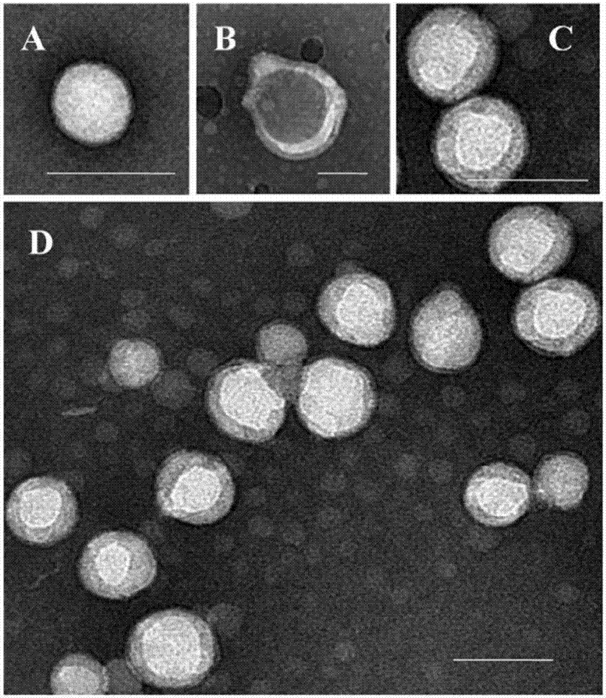 Activated neutrophil membrane coated neutrophil like nanoparticles and preparation method