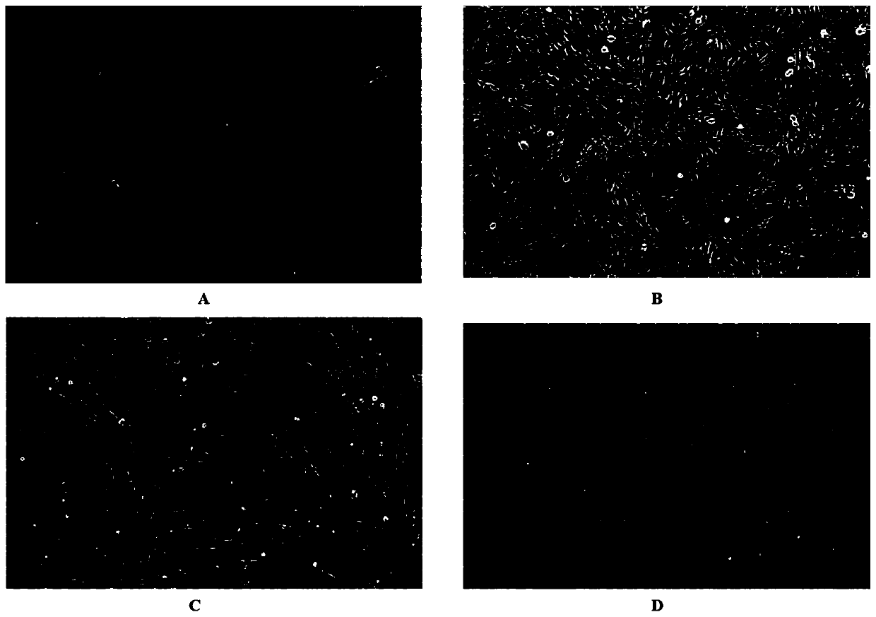 Wubanli (hybrid of channa argus and channa maculata) brain cell line and construction method and application thereof