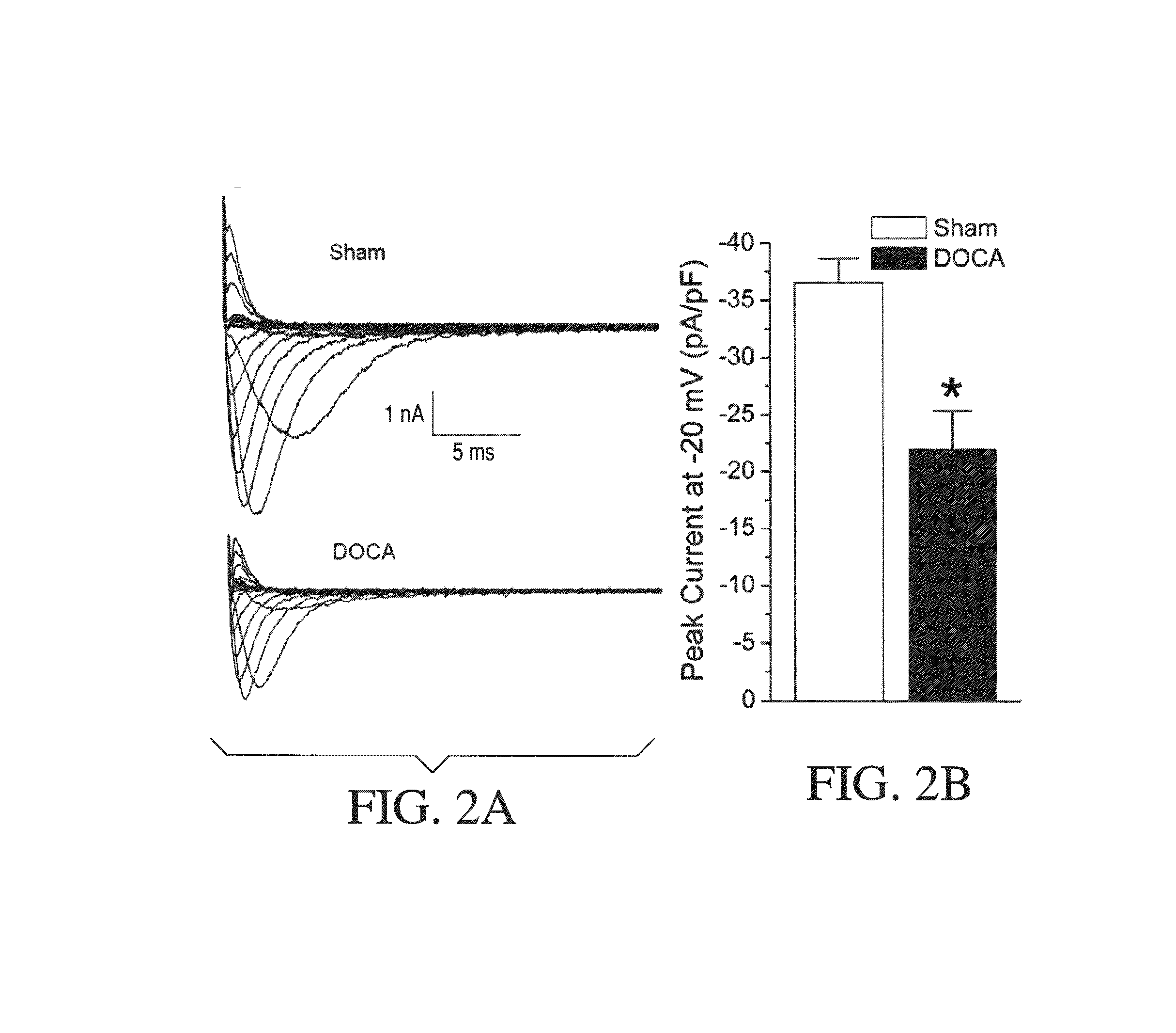 Method for Ameliorating or Preventing Arrhythmic Risk Associated with Cardiomyopathy by Improving Conduction Velocity