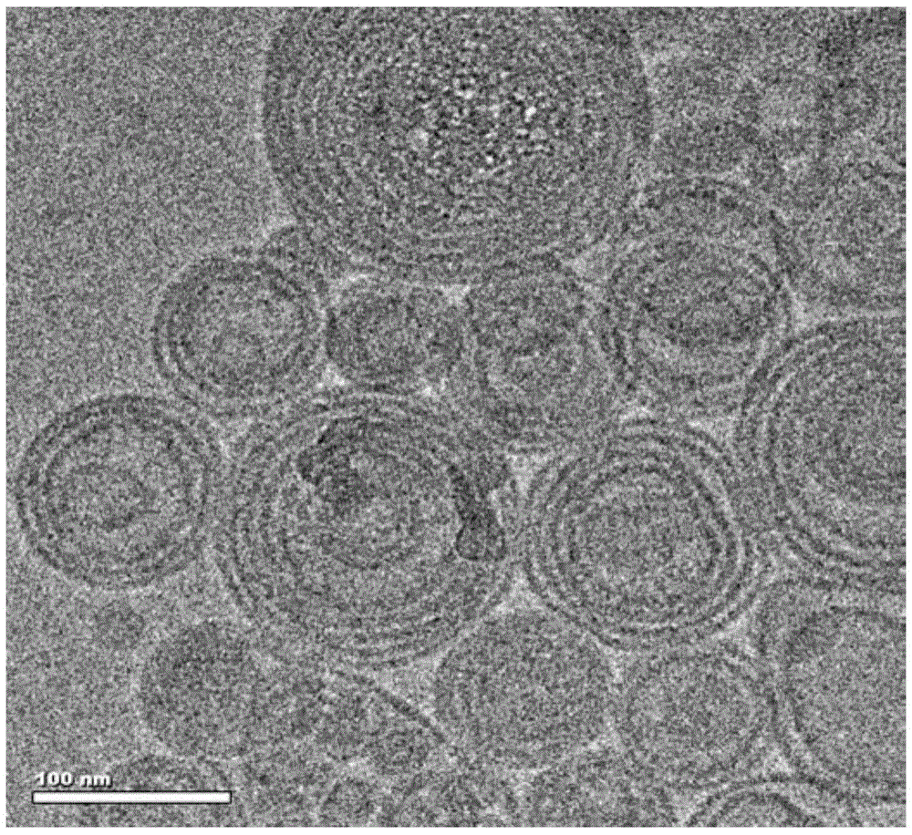 Novel insulin-phospholipid-chitosan self-assembled microparticle carrier and preparation thereof