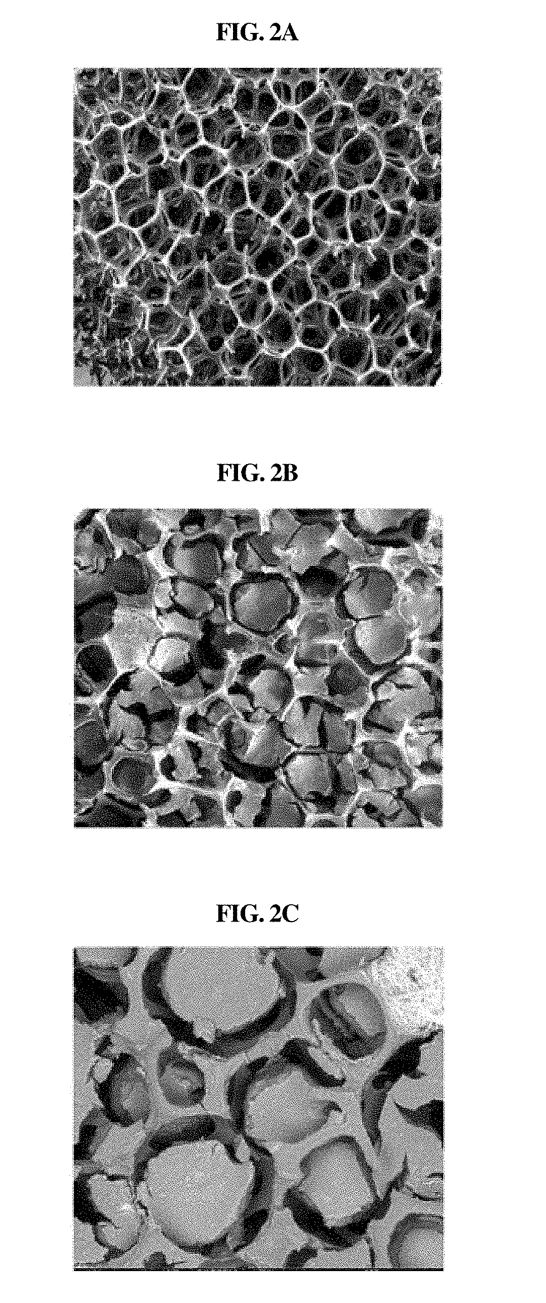 Cathode for lithium air battery having improved capacity and life cycle