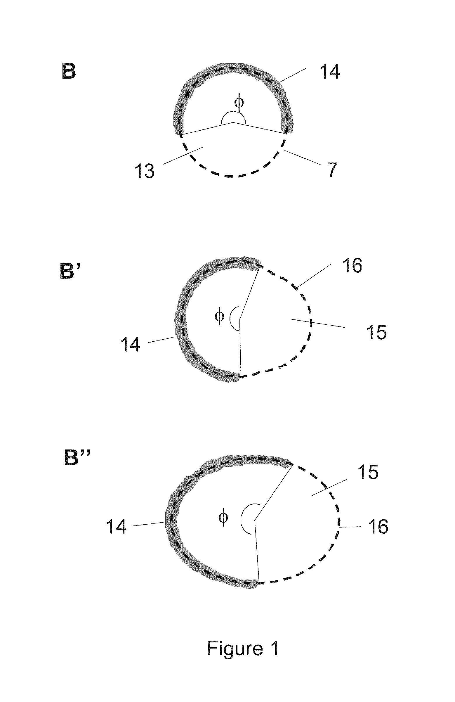 Surgical instrument for the positioning of an alignment element