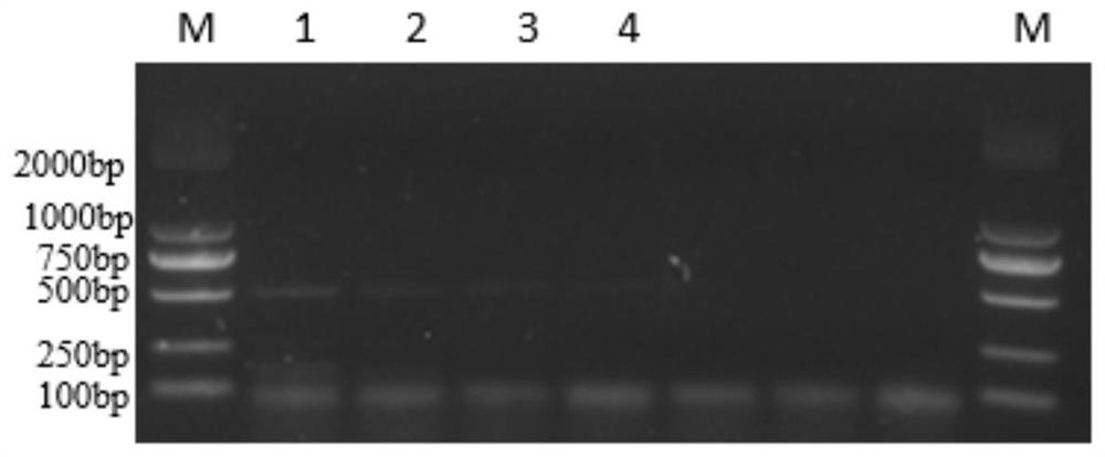 Multiplex PCR detection primer set, method and kit for avian pathogenic Escherichia coli etc.