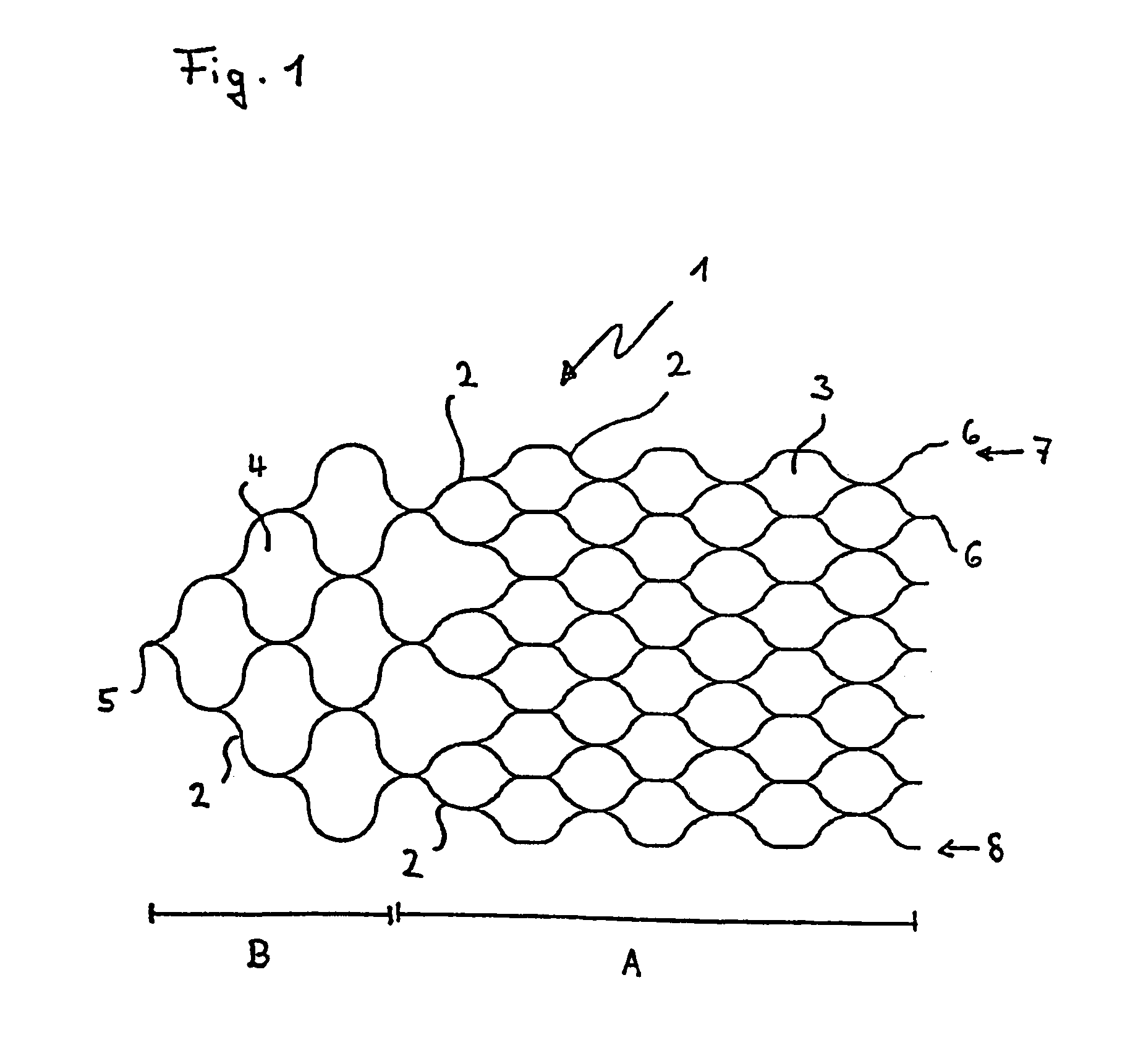 Medical implant having a curlable matrix structure
