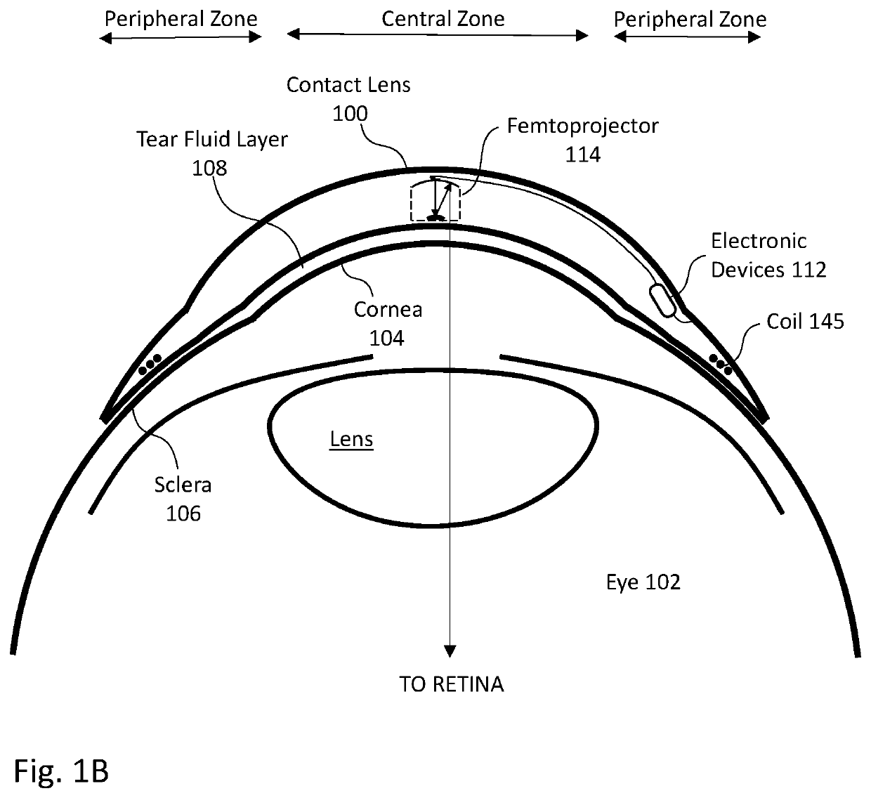 Saccade detection and endpoint prediction for electronic contact lenses, with adjusted operation