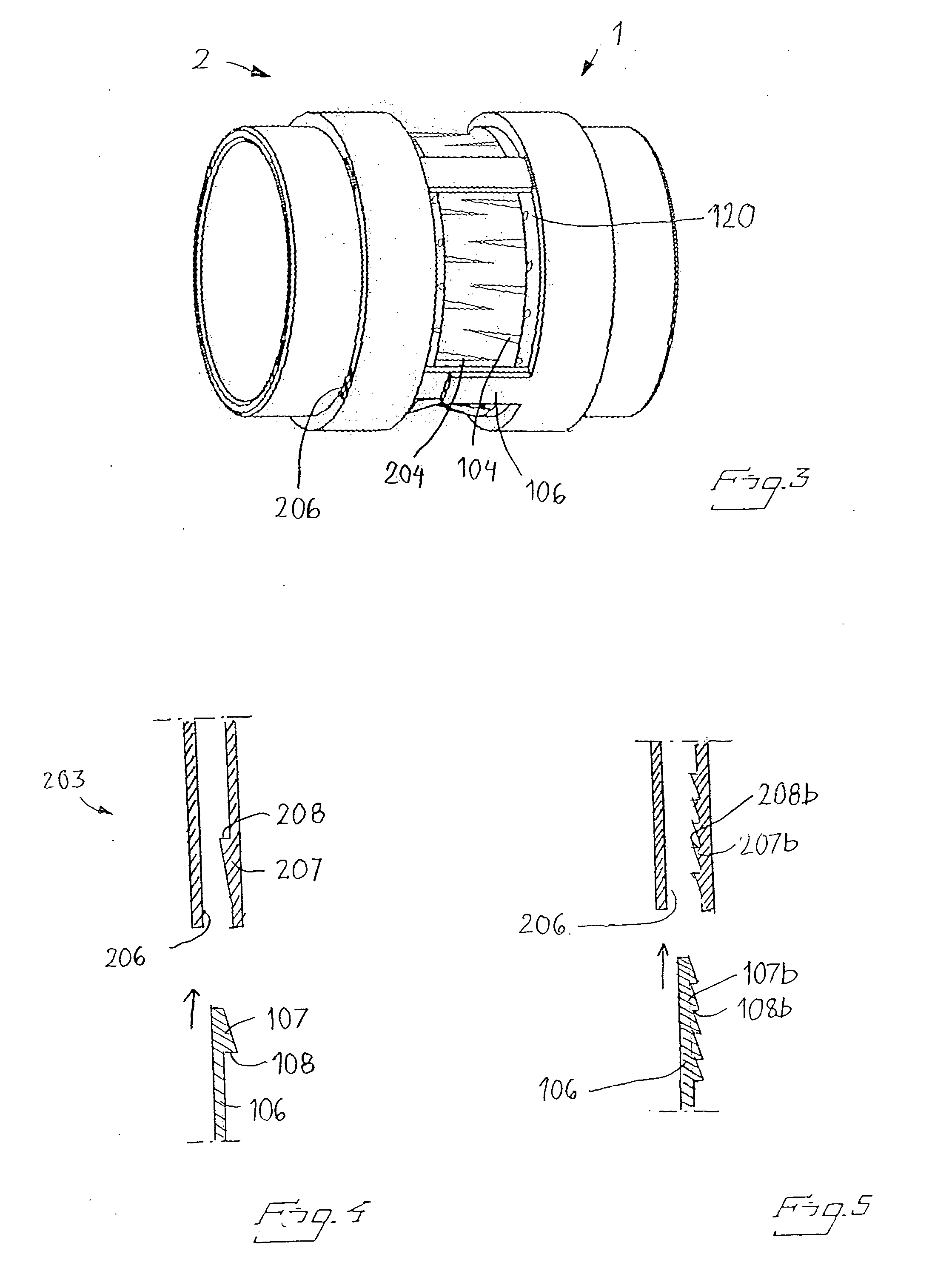 Anastomosis Device and Method