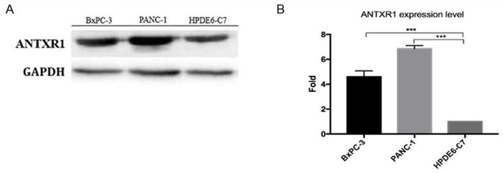 Pancreatic cancer tumor marker and application thereof